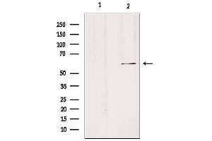 Western blot analysis of extracts from Hela, using SLC24A3 Antibody. (SLC24A3 anticorps  (Internal Region))