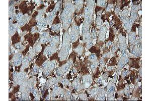 Image no. 1 for anti-Parvin, alpha (PARVA) antibody (ABIN1496444)