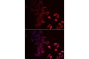Immunofluorescence analysis of MCF7 cells using P2RX4 antibody (ABIN6132449, ABIN6145115, ABIN6145116 and ABIN6222387). (P2RX4 anticorps  (AA 55-338))