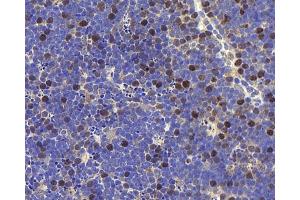 Immunohistochemistry analysis of paraffin-embedded mouse thymus using RACGAP1 Polyclonal Antibody at dilution of 1:400. (RACGAP1 anticorps)