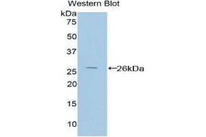 Western Blotting (WB) image for anti-Protein Interacting With Protein Kinase C, alpha 1 (PICK1) (AA 24-229) antibody (ABIN1860209) (PICK1 anticorps  (AA 24-229))