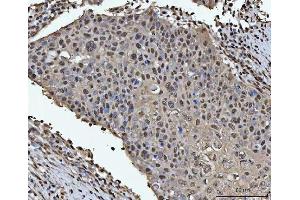 IHC analysis of HOXC4 using anti-HOXC4 antibody (ABIN7603059). (HOXC4 anticorps  (Middle Region))