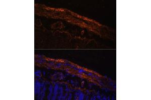 Immunofluorescence analysis of Rat intestine using MYL9 antibody (ABIN3023462, ABIN3023463, ABIN3023464 and ABIN6220005) at dilution of 1:100.