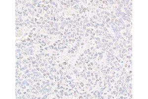 Immunohistochemistry (IHC) image for anti-Structural Maintenance of Chromosomes 3 (SMC3) (C-Term) antibody (ABIN7453572) (SMC3 anticorps  (C-Term))
