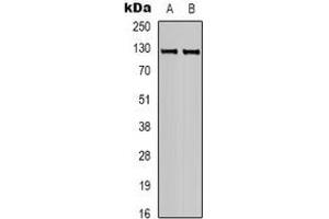 Western blot analysis of CACNA2D3 expression in human brain (A), mouse brain (B) whole cell lysates.