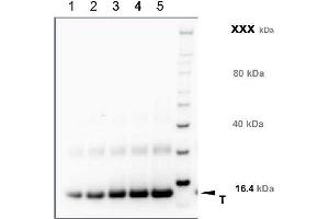 Western Blotting (WB) image for anti-Transmembrane Protein 37 (TMEM37) (N-Term) antibody (ABIN1720796) (TMEM37 anticorps  (N-Term))