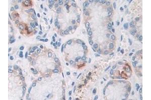 Detection of PYGB in Human Stomach Tissue using Polyclonal Antibody to Glycogen Phosphorylase, Brain (PYGB)