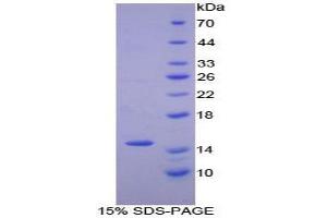 SDS-PAGE analysis of Human Numb Homolog Protein. (NUMB Protéine)