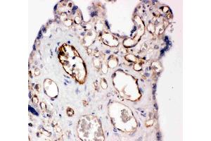 Anti-CD31 antibody, IHC(P): Human Placenta Tissue (CD31 anticorps  (C-Term))
