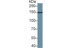 Detection of UACA in Bovine Pancreas lysate using Polyclonal Antibody to Uveal Autoantigen With Coiled Coil Domains And Ankyrin Repeats (UACA)