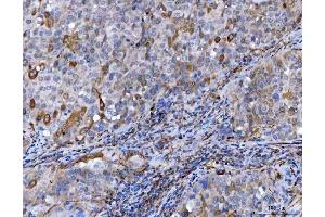 IHC analysis of STBD1 using anti-STBD1 antibody (ABIN7601576).