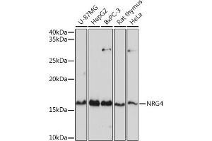 Western blot analysis of extracts of various cell lines, using NRG4 antibody (ABIN3016309, ABIN3016310, ABIN3016311 and ABIN6219713) at 1:1000 dilution.