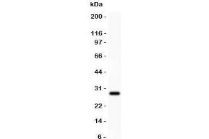 Western blot testing of Amyloid beta antibody and recombinant human protein (0. (APP anticorps  (C-Term))