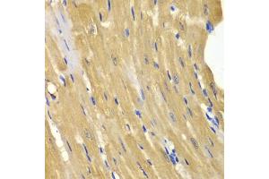 Immunohistochemistry of paraffin-embedded mouse heart using  antibody (ABIN3021755, ABIN3021756, ABIN3021757 and ABIN6215776) at dilution of 1:100 (40x lens).