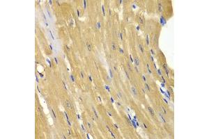 Immunohistochemistry of paraffin-embedded mouse heart using  antibody (ABIN3021755, ABIN3021756, ABIN3021757 and ABIN6215776) at dilution of 1:100 (40x lens). (Adenylate Kinase 1 anticorps  (AA 1-194))
