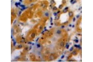 Used in DAB staining on fromalin fixed paraffin-embedded Kidney tissue