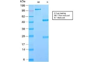 SDS-PAGE Analysis Purified GP2 Recombinant Rabbit Monoclonal Antibody (GP2/2569R). (Recombinant GP2 anticorps  (AA 35-179))