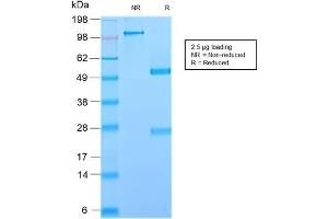 SDS-PAGE Analysis Purified GP2 Recombinant Rabbit Monoclonal Antibody (GP2/2569R). (Recombinant GP2 anticorps  (AA 35-179))