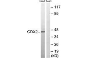 Western blot analysis of extracts from rat heart, using CDX2 (Ab-283) Antibody.