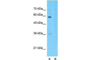 Host:  Rabbit  Target Name:  SMARCD3  Sample Type:  293T  Lane A:  Primary Antibody  Lane B:  Primary Antibody + Blocking Peptide  Primary Antibody Concentration:  1ug/ml  Peptide Concentration:  5ug/ml  Lysate Quantity:  25ug/lane/lane  Gel Concentration:  0.