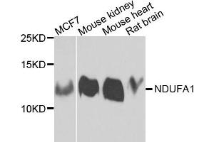 Western blot analysis of extracts of various cells, using NDUFA1 antibody. (NDUFA1 anticorps)