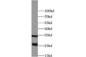 Western blot analysis of Raji cells subjected to SDS-PAGE, using PRSS2 antibody (1/500 dilution). (PRSS2 anticorps)