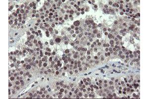 Image no. 9 for anti-Zinc Finger, BED-Type Containing 1 (ZBED1) antibody (ABIN1501794)