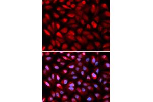 Immunofluorescence (IF) image for anti-Poly(rC) Binding Protein 2 (PCBP2) (AA 1-130) antibody (ABIN6219620) (PCBP2 anticorps  (AA 1-130))