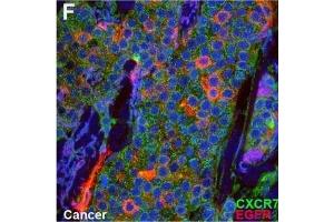 CXCR7 co-localizes with EGFR.