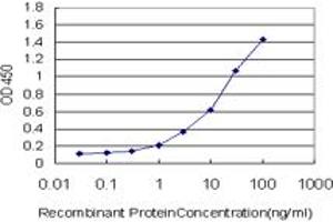 Detection limit for recombinant GST tagged ZNF263 is approximately 0.