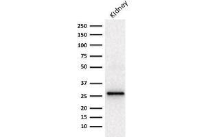 Western blot Analysis of human Kidney lysate using Adiponectin Mouse Monoclonal Antibody (ADPN/1370). (ADIPOQ anticorps  (AA 145-226))