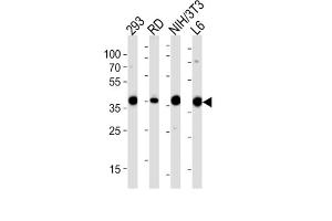 Western Blotting (WB) image for anti-Aldolase (ALD) antibody (ABIN3001589) (Aldolase anticorps)