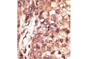 Image no. 2 for anti-CAMP Responsive Element Binding Protein 3-Like 1 (CREB3L1) (AA 490-519), (C-Term) antibody (ABIN358719) (CREB3L1 anticorps  (C-Term))