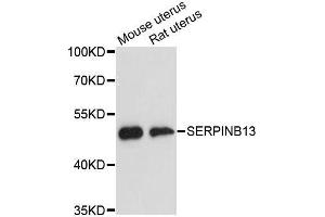 Western blot analysis of extracts of various cell lines, using SERPINB13 antibody. (SERPINB13 anticorps  (AA 1-140))