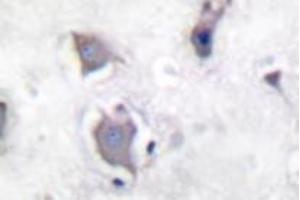 Image no. 2 for anti-Neurotrophic Tyrosine Kinase, Receptor, Type 2 (NTRK2) (pTyr705) antibody (ABIN318147) (TRKB anticorps  (pTyr705))