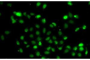 Immunofluorescence analysis of A549 cells using BCL6 Polyclonal Antibody (BCL6 anticorps)