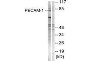 Western blot analysis of extracts from Jurkat cells, using PECAM-1 (Ab-713) Antibody. (CD31 anticorps  (AA 686-735))