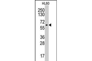 Western blot analysis of CYP19A1 polyclonal antibody  in HL-60 cell line lysates (35 ug/lane). (Aromatase anticorps  (Internal Region))