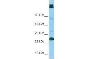 Western Blotting (WB) image for anti-Lymphocyte Antigen 6 Complex, Locus G5C (LY6G5C) (C-Term) antibody (ABIN2444645) (LY6G5C anticorps  (C-Term))