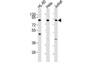 All lanes : Anti-IKK beta Antibody at 1:4000 dilution Lane 1: HL-60 whole cell lysates Lane 2: Hela whole cell lysates Lane 3: Jurkat whole cell lysates Lysates/proteins at 20 μg per lane. (IKBKB anticorps)