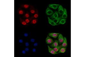 PHF8 Antibody staining Hela cells by IF/ICC. (PHF8 anticorps  (C-Term))