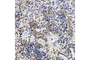 Immunohistochemistry of paraffin-embedded rat spleen using PER2 Rabbit pAb (ABIN6131889, ABIN6145450, ABIN6145452 and ABIN6217063) at dilution of 1:100 (40x lens).