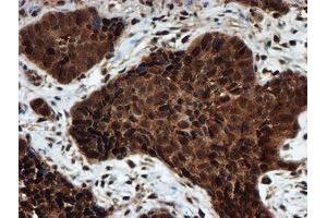 Image no. 9 for anti-Proteasome Subunit alpha 6 (PSMA6) antibody (ABIN1500464)