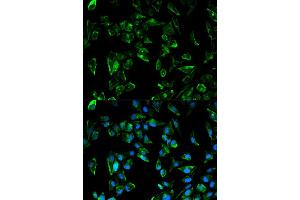 Immunofluorescence analysis of HeLa cell using TPM3 antibody. (TPM3 anticorps)