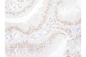 Immunohistochemistry (IHC) image for anti-Myocyte Enhancer Factor 2A (MEF2A) (AA 175-225) antibody (ABIN7454560)