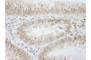 Immunohistochemistry (IHC) image for anti-Polymerase (DNA Directed), epsilon 3 (p17 Subunit) (POLE3) (AA 97-147) antibody (ABIN7448733)