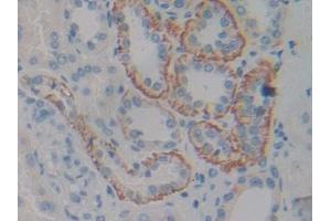 DAB staining on IHC-P; Samples: Human Kidney Tissue (CNTF Receptor alpha anticorps  (AA 120-358))