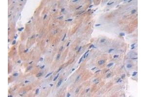 Detection of LTBP1 in Mouse Heart Tissue using Polyclonal Antibody to Latent Transforming Growth Factor Beta Binding Protein 1 (LTBP1)