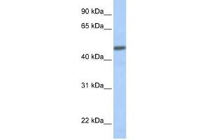 CALCRL antibody used at 1 ug/ml to detect target protein. (CALCRL anticorps  (N-Term))