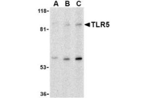 Image no. 1 for anti-Toll-Like Receptor 5 (TLR5) (C-Term) antibody (ABIN265142) (TLR5 anticorps  (C-Term))